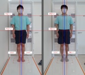 엠에스알운동재활 동탄점