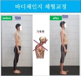 바디체인지 체형교정