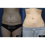 모델라인의원 강남점