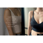 모델라인의원 강남점