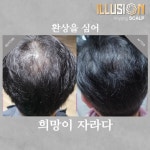 일루젼스칼프 안양점