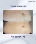 일루젼스칼프 안양점