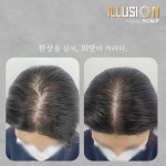 일루젼스칼프 안양점