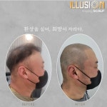 일루젼스칼프 안양점
