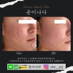 윤이나다