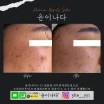 윤이나다