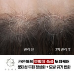 라온하제 두피 탈모케어 눈썹 속눈썹펌 천안본점