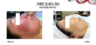 맑은피부에스테틱