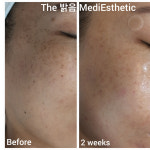 더밝음메디에스테틱