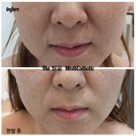 더밝음메디에스테틱