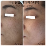 더밝음메디에스테틱