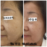 더밝음메디에스테틱