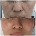 더밝음메디에스테틱