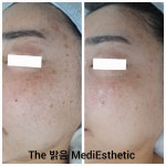 더밝음메디에스테틱