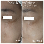 더밝음메디에스테틱