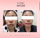 루덴스