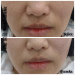 더밝음메디에스테틱