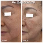 더밝음메디에스테틱