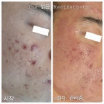 더밝음메디에스테틱