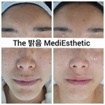 더밝음메디에스테틱