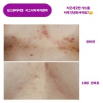 도드리뷰티어겐 | 강스뷰티어겐