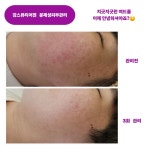 도드리뷰티어겐 | 강스뷰티어겐