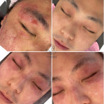 유앤희에스테틱 광주첨단점