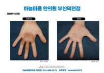 하늘마음한의원 부산덕천