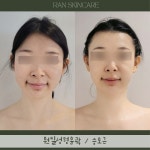 부천중동 란스킨케어