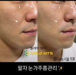 플라즈마불레부뷰티