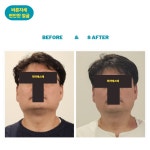 라라에스떼/ 얼굴축소연구소