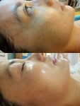 송탄피부관리소소야