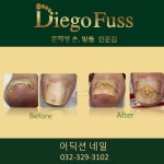 부천디에고푸스본점어딕션네일&풋케어전문