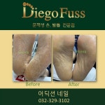 부천디에고푸스본점어딕션네일&풋케어전문