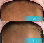 스킨소울