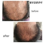 디에이치스킨스칼프
