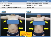 비티엘플러스