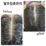 디에이치스킨스칼프