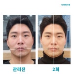 라라에스떼/ 얼굴축소연구소