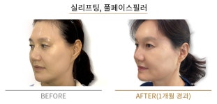더붐의원 부산서면