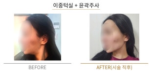 더붐의원 부산서면
