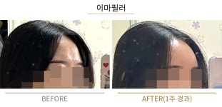 더붐의원 부산서면
