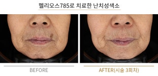 더붐의원 부산서면
