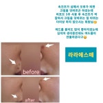 라라에스떼/ 얼굴축소연구소