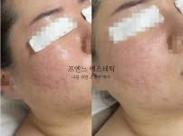 라온제이 에스테틱