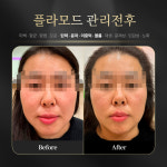 피부의달인샵