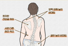 넘버원 척추골반교정센터