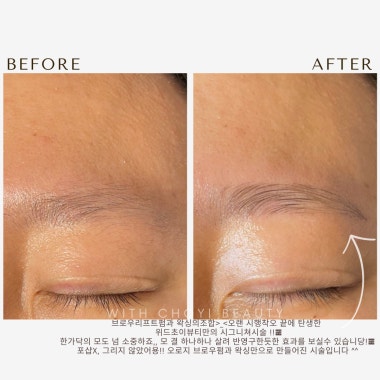 광고 이미지