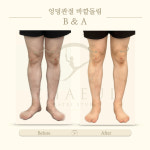 체형분석운동센터 채울필라테스 일광점