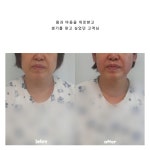 더테라피샵